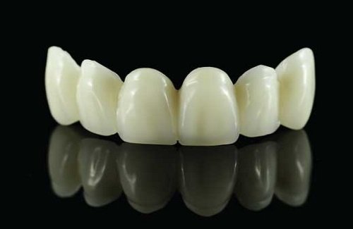 all-ceramic