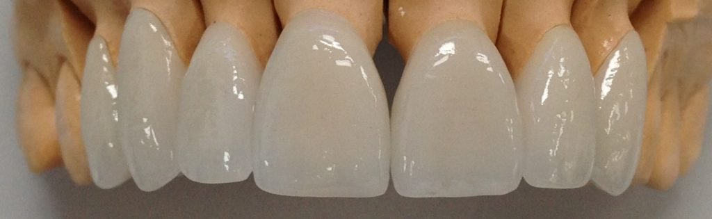anterior